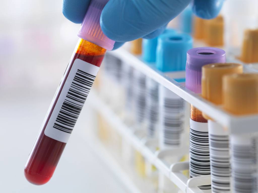 Why Extensive Blood Diagnostic Testing is a Game Changer